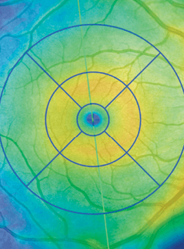 Macula--light-sensitive-center of the retina