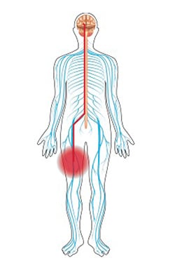 Spasticity in MS is most common in the legs, where it can cause painful, uncontrollable contractions. Damage to the nerves that control impulses to the muscles causes spasticity.