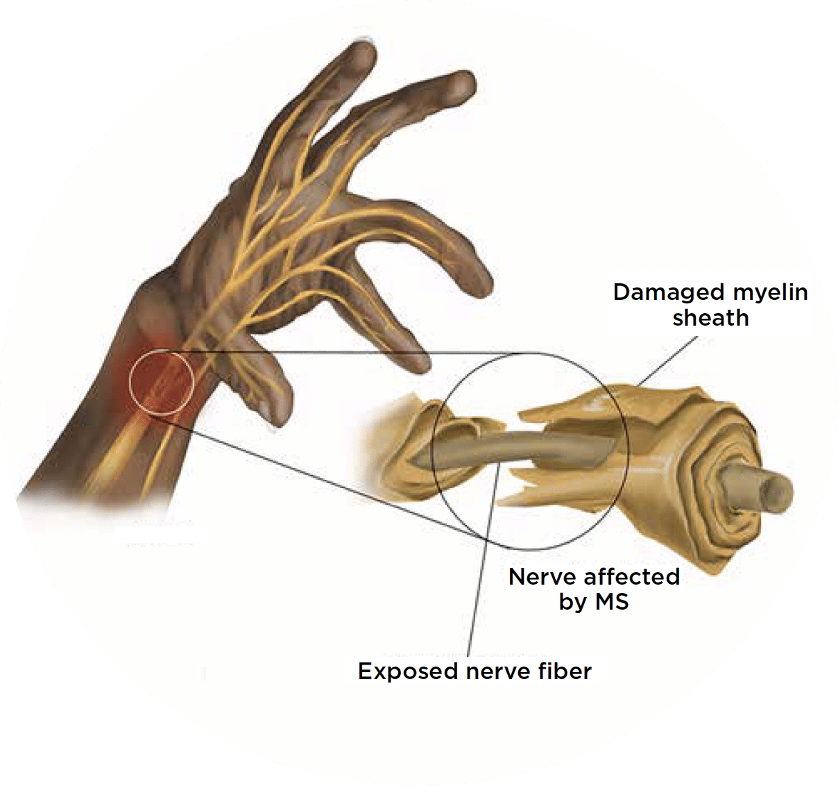wrist nerve diagram